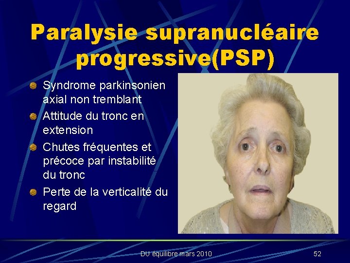 Paralysie supranucléaire progressive(PSP) Syndrome parkinsonien axial non tremblant Attitude du tronc en extension Chutes