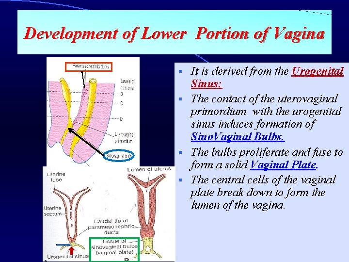 Development of Lower Portion of Vagina It is derived from the Urogenital Sinus: §