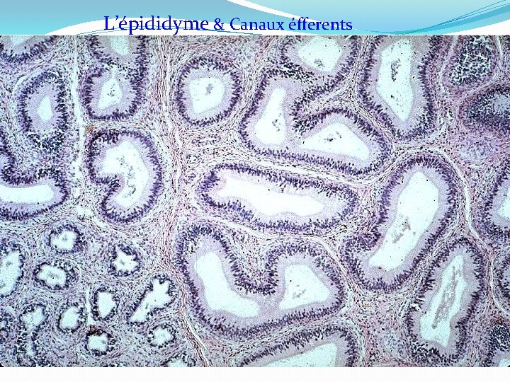 L’épididyme & Canaux éfferents 