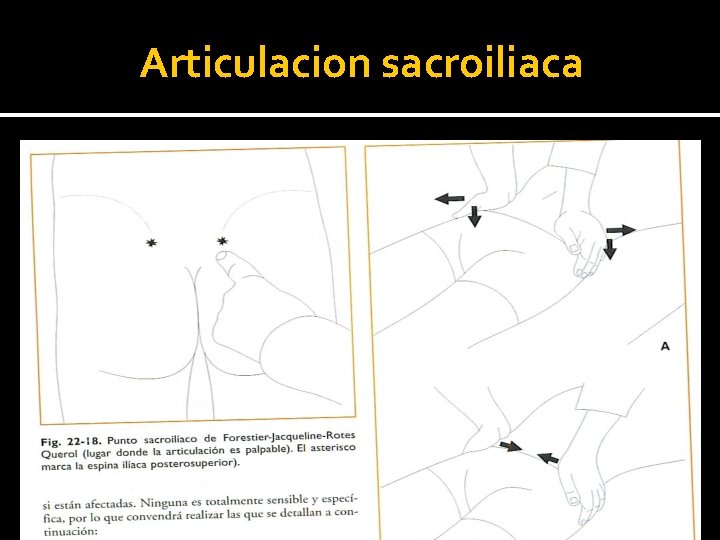 Articulacion sacroiliaca 