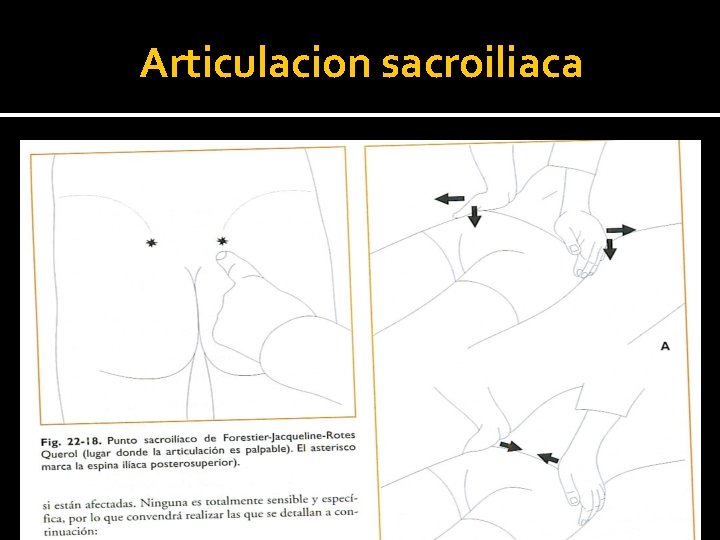 Articulacion sacroiliaca Articulacion sacroiliaca