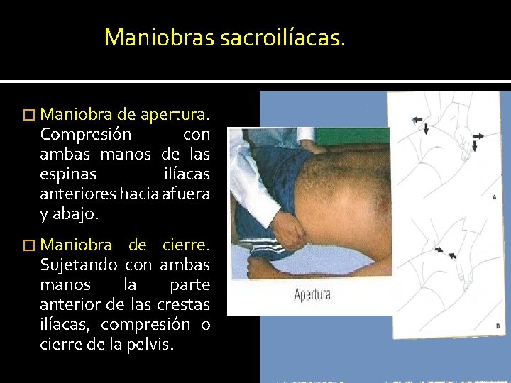 Maniobras sacroilíacas. � Maniobra de apertura. Compresión con ambas manos de las espinas ilíacas Maniobras sacroilíacas. � Maniobra de apertura. Compresión con ambas manos de las espinas ilíacas