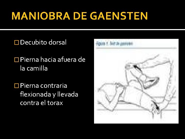 MANIOBRA DE GAENSTEN � Decubito dorsal � Pierna hacia afuera de la camilla �