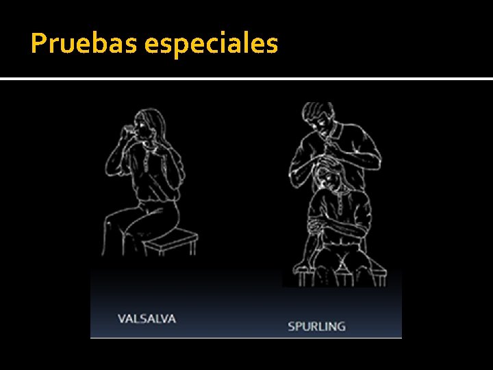Pruebas especiales Pruebas especiales