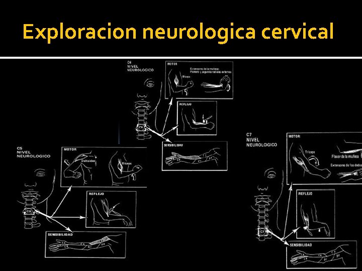 Exploracion neurologica cervical 