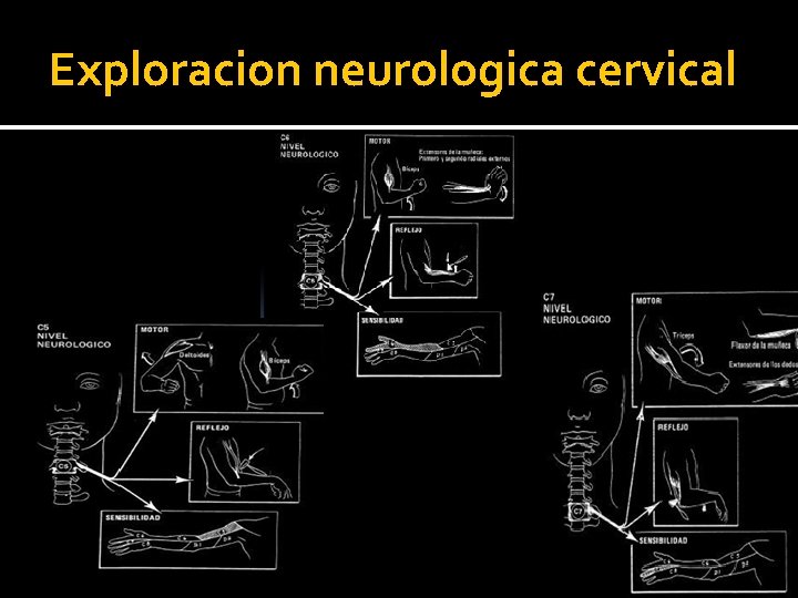 Exploracion neurologica cervical Exploracion neurologica cervical
