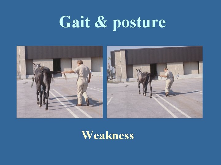 Gait & posture Weakness 