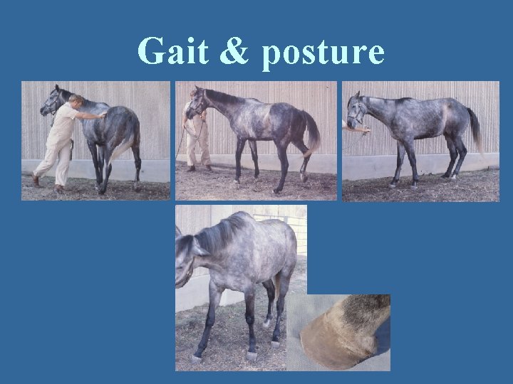 Gait & posture 