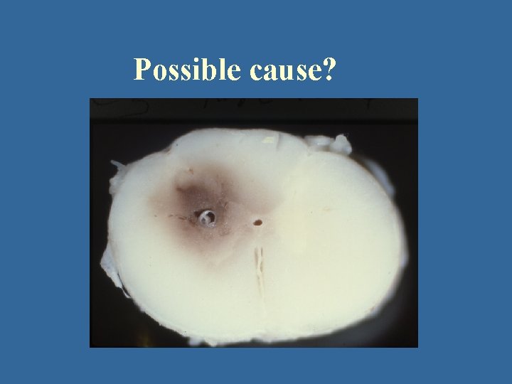 Possible cause? 