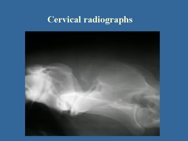 Cervical radiographs 