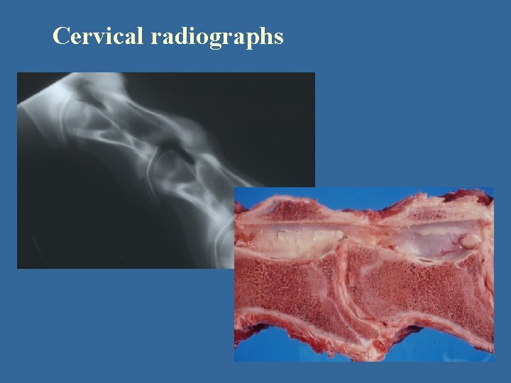 Cervical radiographs 