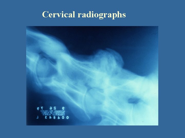 Cervical radiographs 