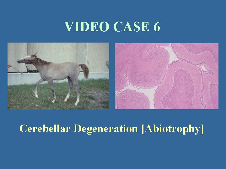 VIDEO CASE 6 Cerebellar Degeneration [Abiotrophy] 
