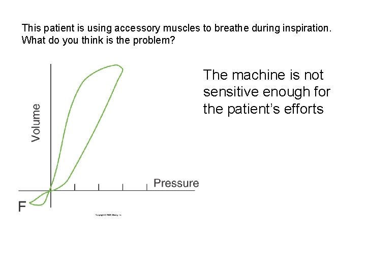 This patient is using accessory muscles to breathe during inspiration. What do you think