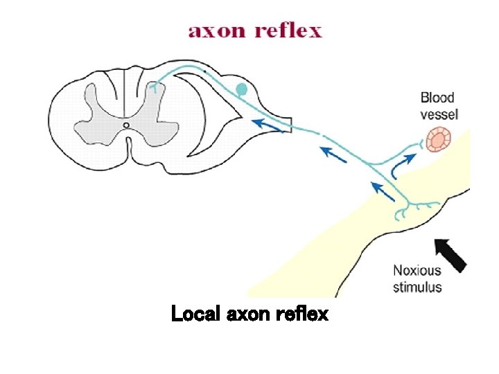 Local axon reflex Local axon reflex