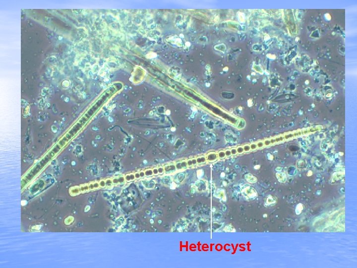 Heterocyst 