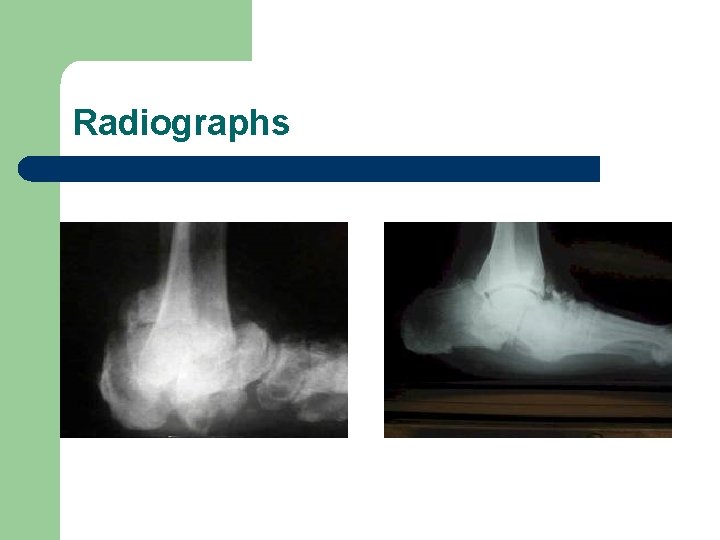 Radiographs 