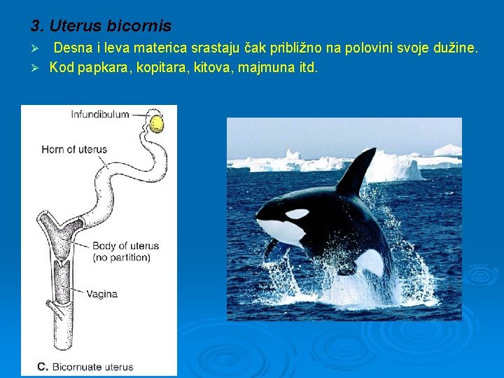 3. Uterus bicornis Desna i leva materica srastaju čak približno na polovini svoje dužine.