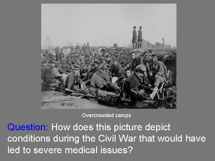 Overcrowded camps Question: How does this picture depict conditions during the Civil War that