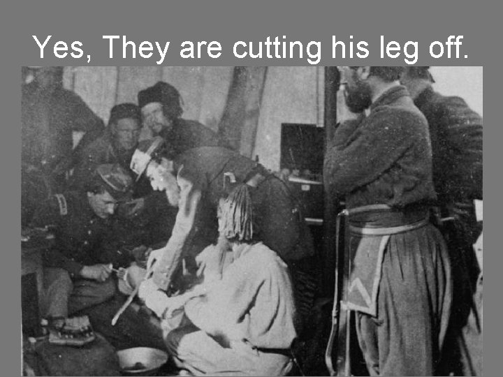 Yes, They are cutting his leg off. 