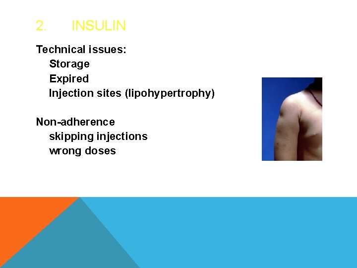 2. INSULIN Technical issues: Storage Expired Injection sites (lipohypertrophy) Non-adherence skipping injections wrong doses