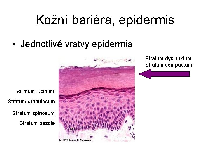 Kožní bariéra, epidermis • Jednotlivé vrstvy epidermis Stratum dysjunktum Stratum corneum Stratum compactum Stratum