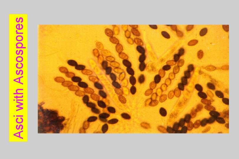 Asci with Ascospores 