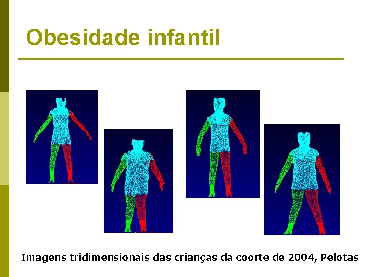 Obesidade infantil Imagens tridimensionais das crianças da coorte de 2004, Pelotas 
