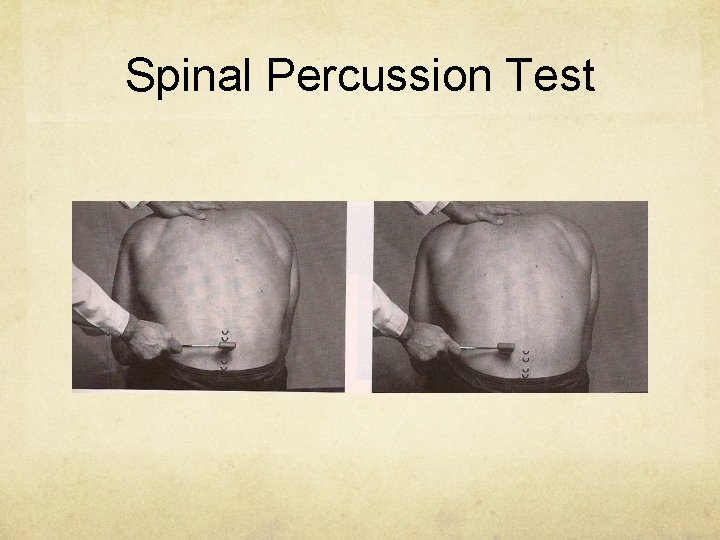 Spinal Percussion Test 