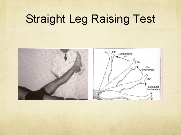 Straight Leg Raising Test 