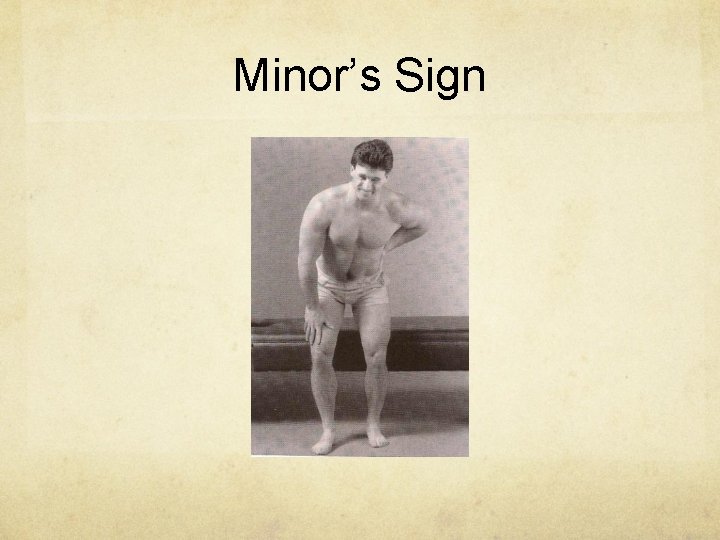 Minor’s Sign 