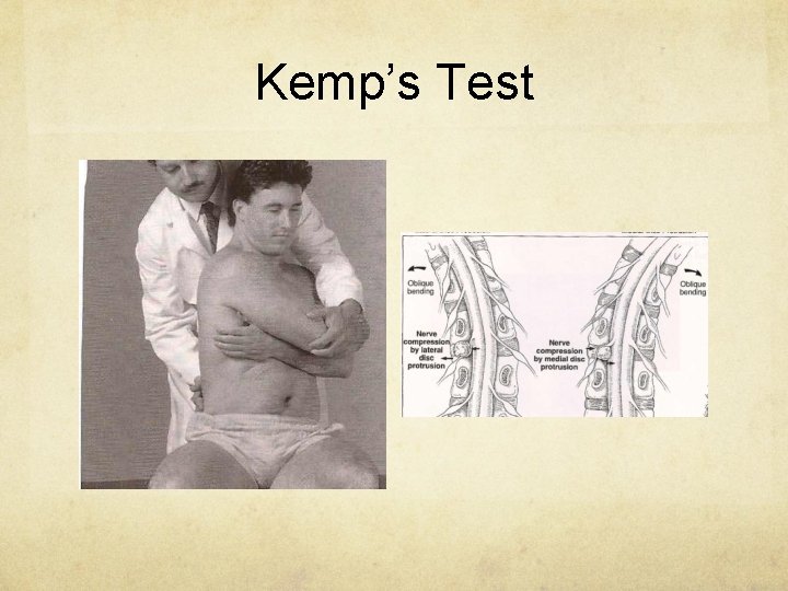 Kemp’s Test 