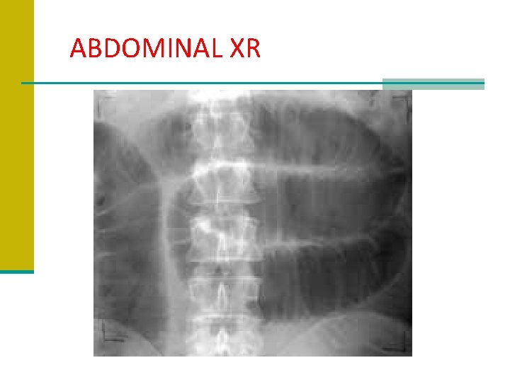 ABDOMINAL XR 