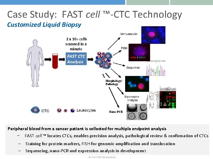 Case Study: FAST cell ™-CTC Technology Customized Liquid Biopsy 2 x 10 7 cells