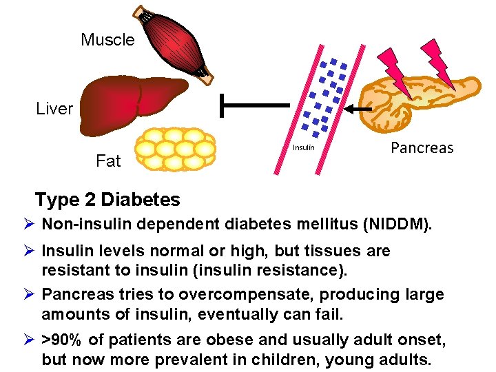 Muscle Liver Fat Insulin Pancreas Type 2 Diabetes Ø Non-insulin dependent diabetes mellitus (NIDDM).