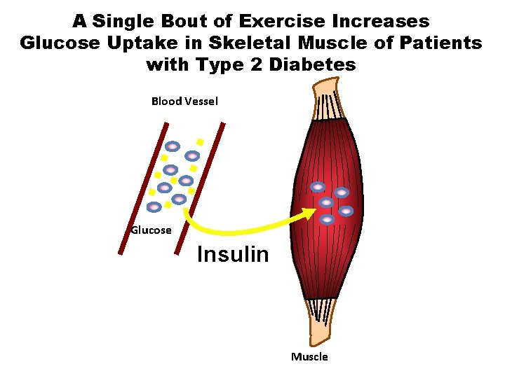 A Single Bout of Exercise Increases Glucose Uptake in Skeletal Muscle of Patients with