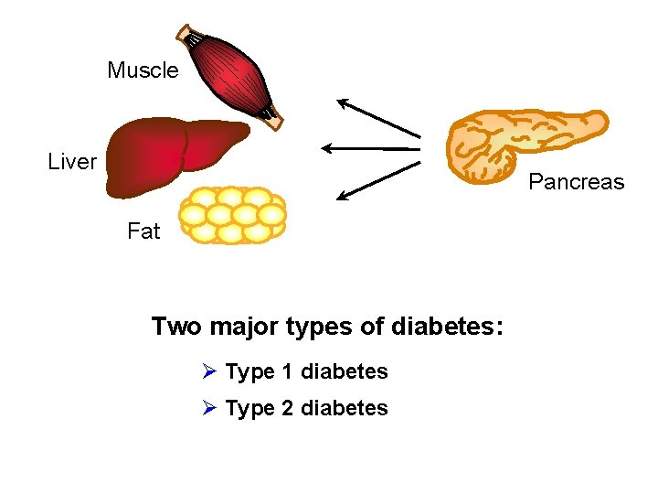 Muscle Liver Pancreas Fat Two major types of diabetes: Ø Type 1 diabetes Ø