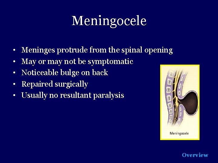 Meningocele • • • Meninges protrude from the spinal opening May or may not