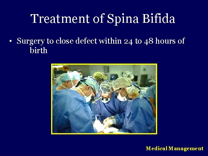 Treatment of Spina Bifida • Surgery to close defect within 24 to 48 hours