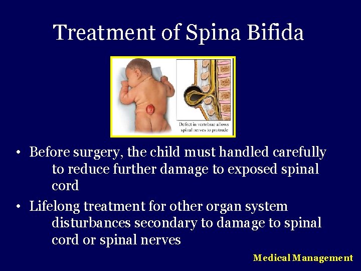 Treatment of Spina Bifida • Before surgery, the child must handled carefully to reduce
