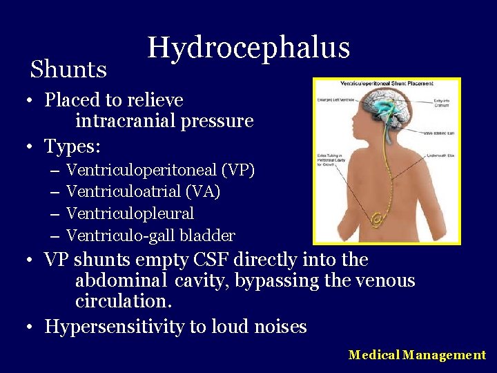 Shunts Hydrocephalus • Placed to relieve intracranial pressure • Types: – – Ventriculoperitoneal (VP)