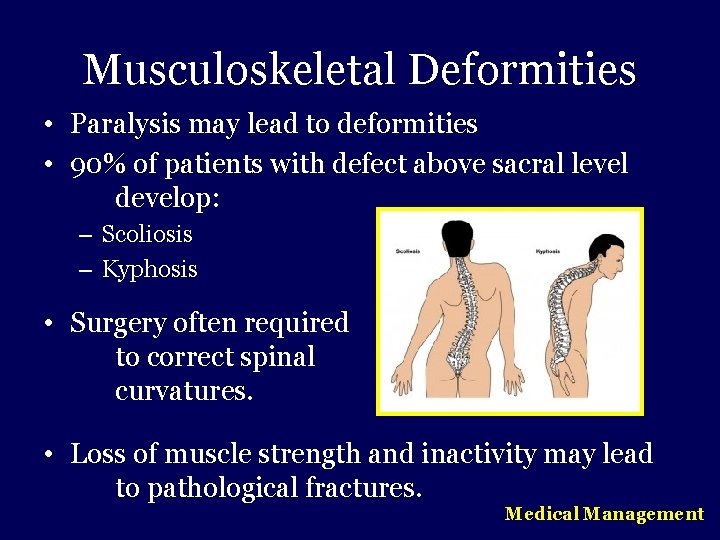 Musculoskeletal Deformities • Paralysis may lead to deformities • 90% of patients with defect