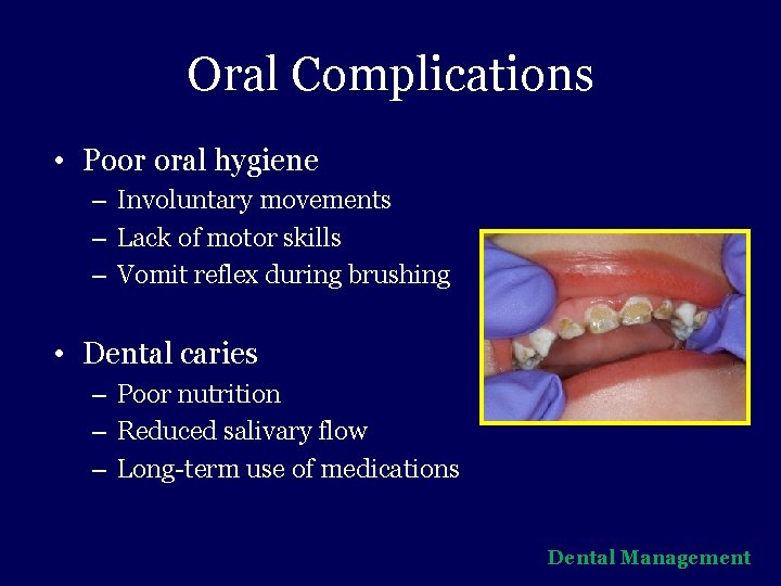 Oral Complications • Poor oral hygiene – Involuntary movements – Lack of motor skills