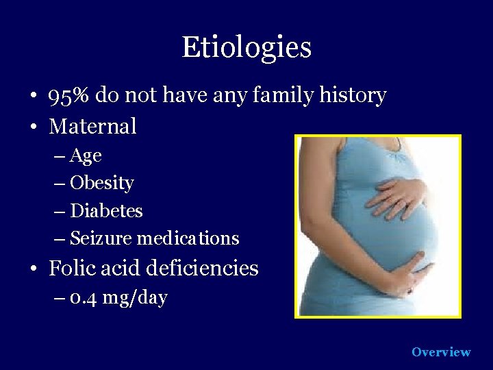 Etiologies • 95% do not have any family history • Maternal – Age –