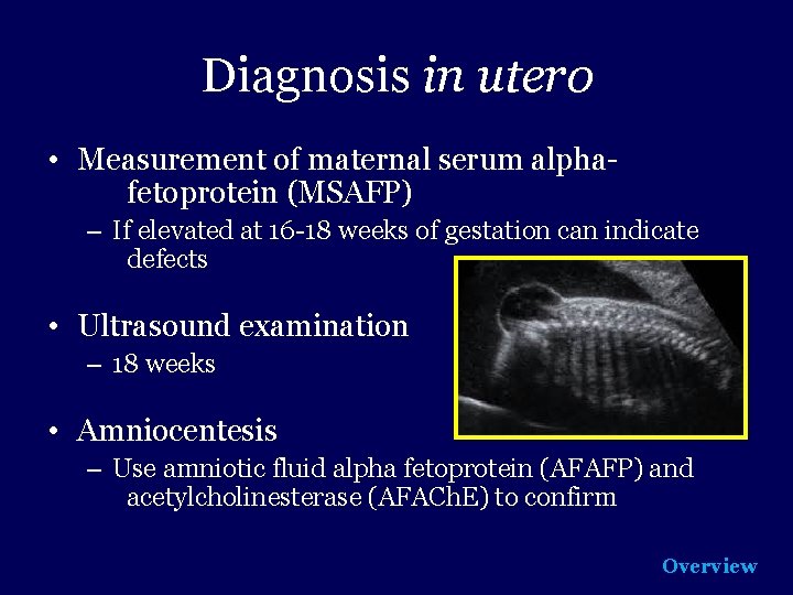 Diagnosis in utero • Measurement of maternal serum alphafetoprotein (MSAFP) – If elevated at