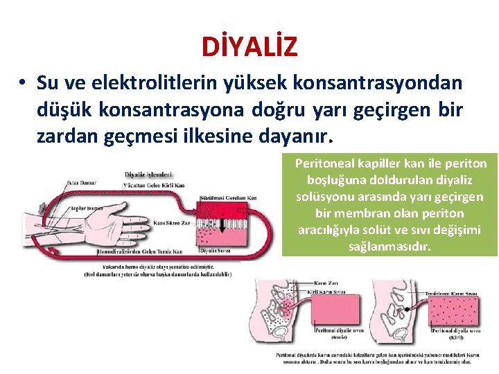 DİYALİZ • Su ve elektrolitlerin yüksek konsantrasyondan düşük konsantrasyona doğru yarı geçirgen bir zardan