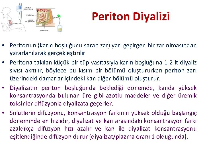 Periton Diyalizi • Peritonun (karın boşluğunu saran zar) yarı geçirgen bir zar olmasından yararlanılarak