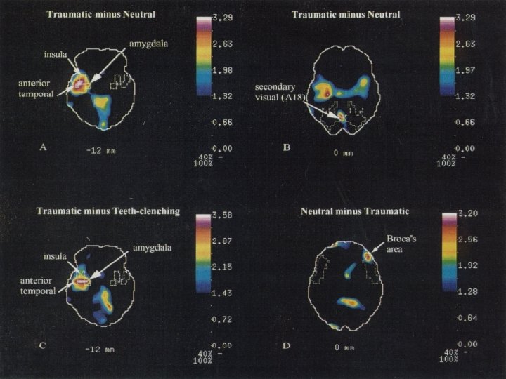 Rauch Brain scans 