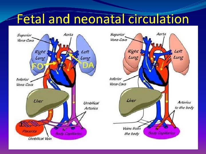 Fetal and neonatal circulation 