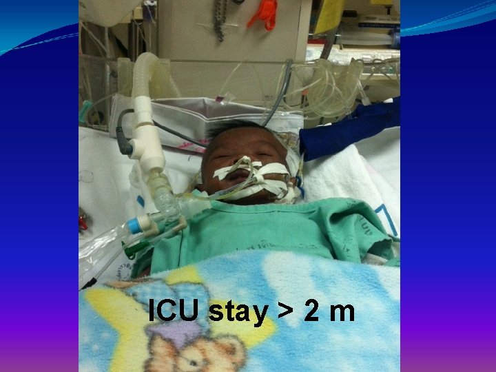 ICU stay > 2 m 